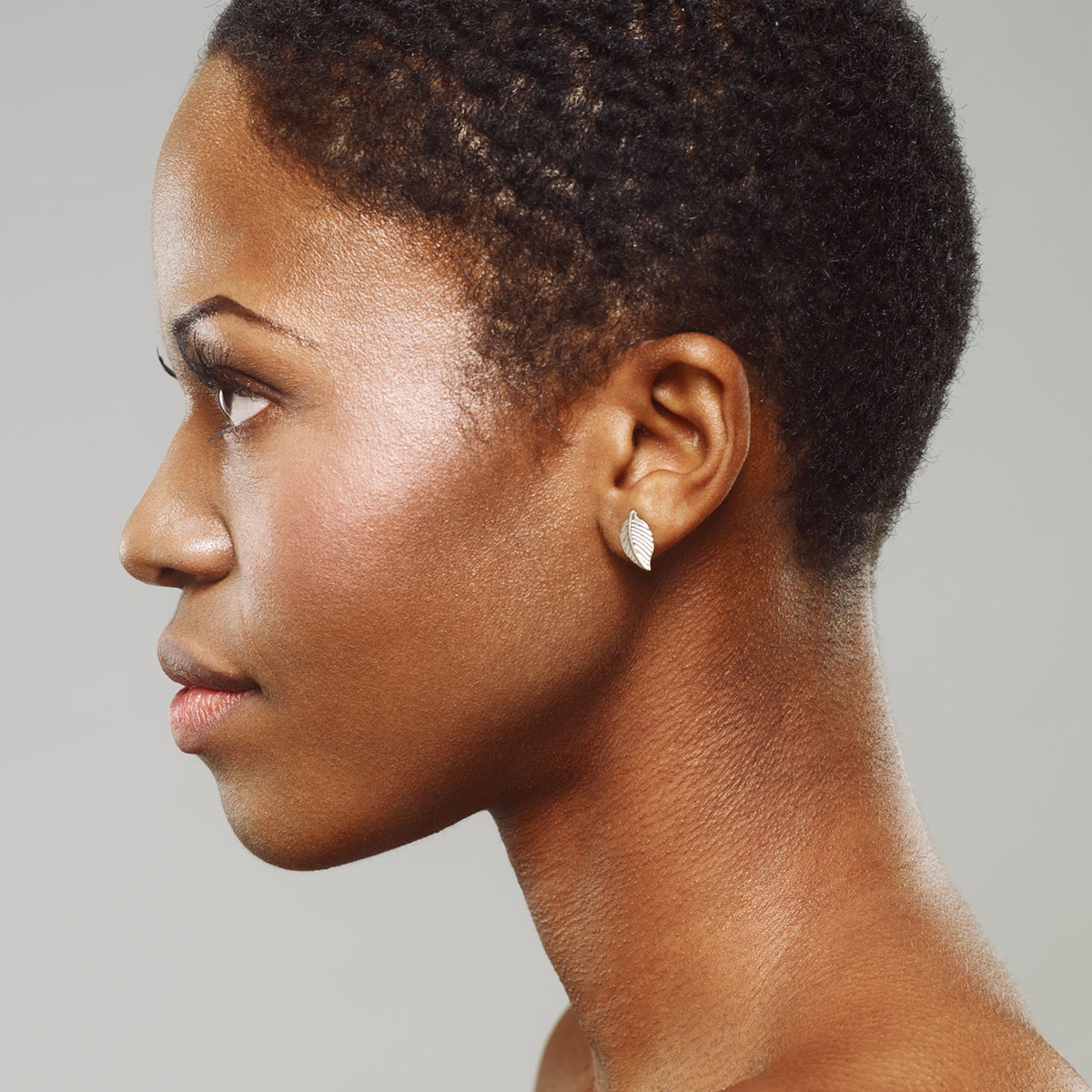 woman after kybella in Sarasota
