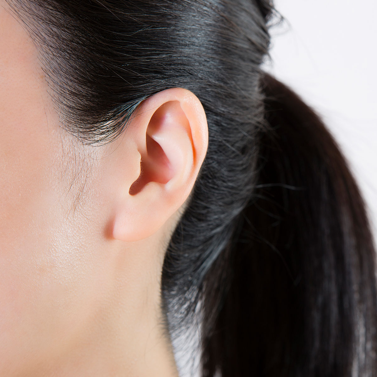 woman after earlobe otoplasty in Sarasota