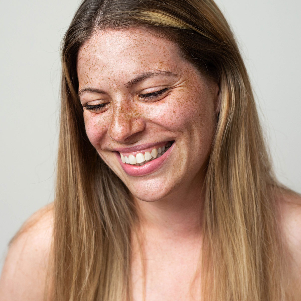 woman after botox in Sarasota